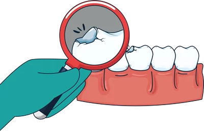 esnan-zirconia-crowns-in-turkey Explore Esnan's zirconia crowns in Turkey. Discover high-quality dental solutions offering durability, aesthetics, and functional restoration for your smile.