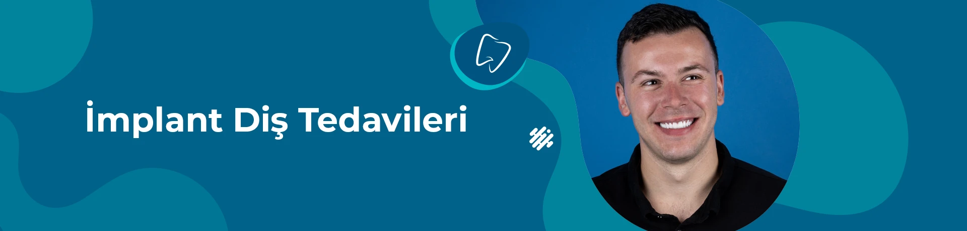 İmplant diş tedavileri, eksik olan dişlerin fonksiyon ve estetiğini tekrar sağlamak amacıyla çene kemiğine yerleştirilen yapay diş köküdür.