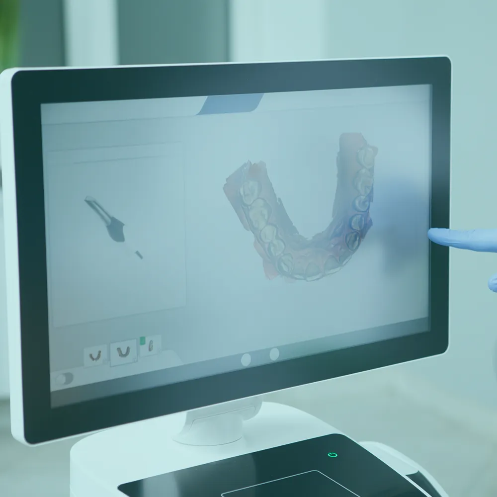 Digital imaging in Istanbul, offering advanced imaging technology and high-quality diagnostic services for precise medical assessments.