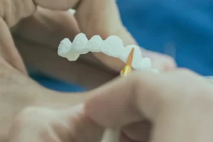 Restore your smile with porcelain-crowns for durable and natural-looking teeth. Our porcelain-crowns offer strength and aesthetics.