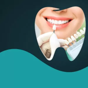 Transform your smile with laminate veneer treatment in Turkey. Discover natural-looking results and expert care with Esnan.