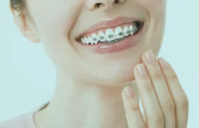 Orthodontics in Turkey, providing good orthodontic treatments and high-quality care for straightening teeth and improving smiles.