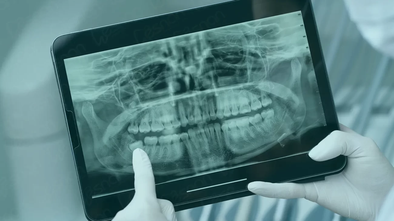 Radiology in Turkey, providing advanced imaging services and high-quality diagnostic care for accurate medical assessments.