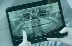 Radiology in Turkey, providing advanced imaging services and high-quality diagnostic care for accurate medical assessments.