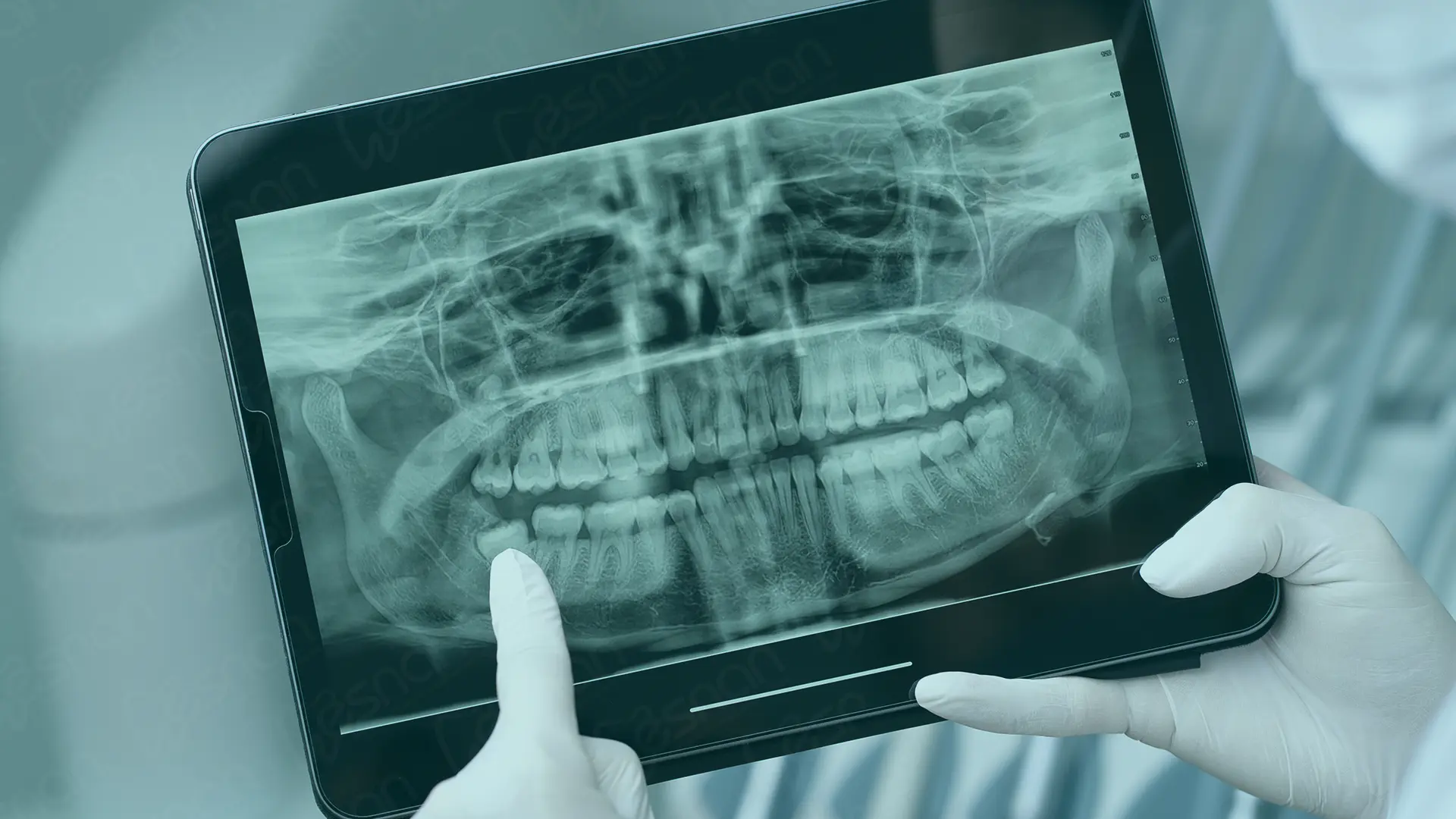 Radiology in Turkey, providing advanced imaging services and high-quality diagnostic care for accurate medical assessments.