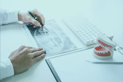 Dental crowns in Turkey may be defined as special artificial coverings that enable the restoration of function, strength, and the appearance of such teeth.