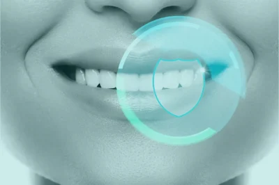 Digital Smile Design