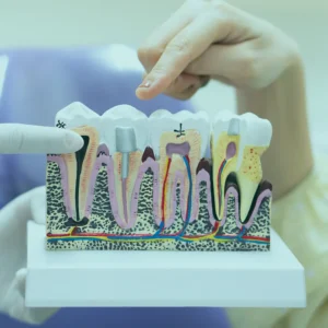 The dental implant in Turkey is characterized by relentless innovation, driven by a commitment to excellence and a passion for advancing patient care.