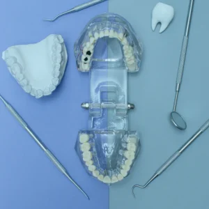 قشور الأسنان في تركيا