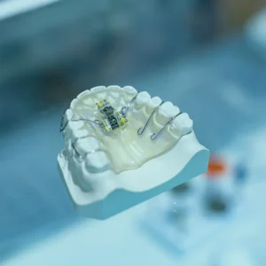 تيجان الأسنان في أسطنبول