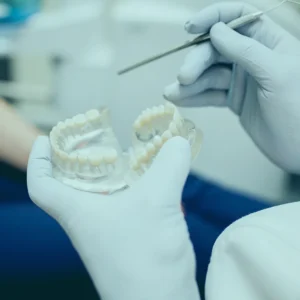 زراعة الأسنان في تركيا