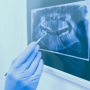 X-rays, computed tomography scans (CT), and magnetic resonance imaging (MRI) are the main imaging tools used in dental radiology in Turkey. 