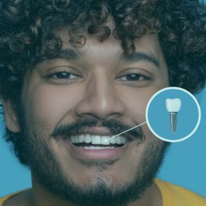 تصميم الابتسامة في تركيا