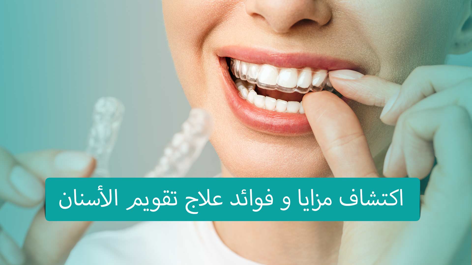 تقويم الأسنان في تركيا يتميز بالتقنيات المتطورة والفرق الطبية المتخصصة، مما يساعد على تحسين مظهر الأسنان ووظائفها بشكل فعال وجودة عالية.