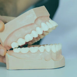 زراعة الاسنان في تركيا