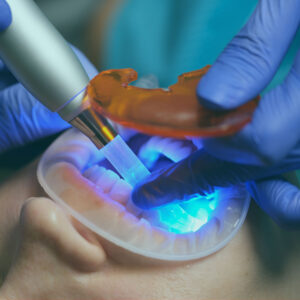Explore the benefits of laser dentistry in Turkey while enjoying painless and worry-free dentistry from the well-equipped medical institutions.