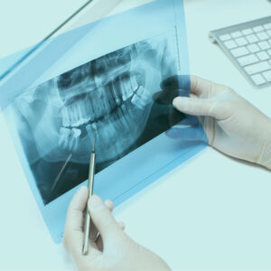 Enhancing Diagnostic Accuracy with Digital X-Rays