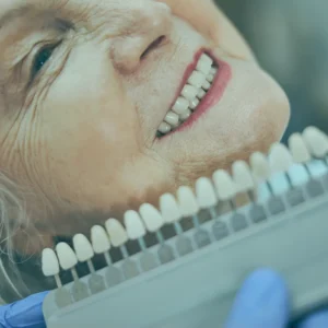 Dental veneers being applied by a dentist in a dental clinic