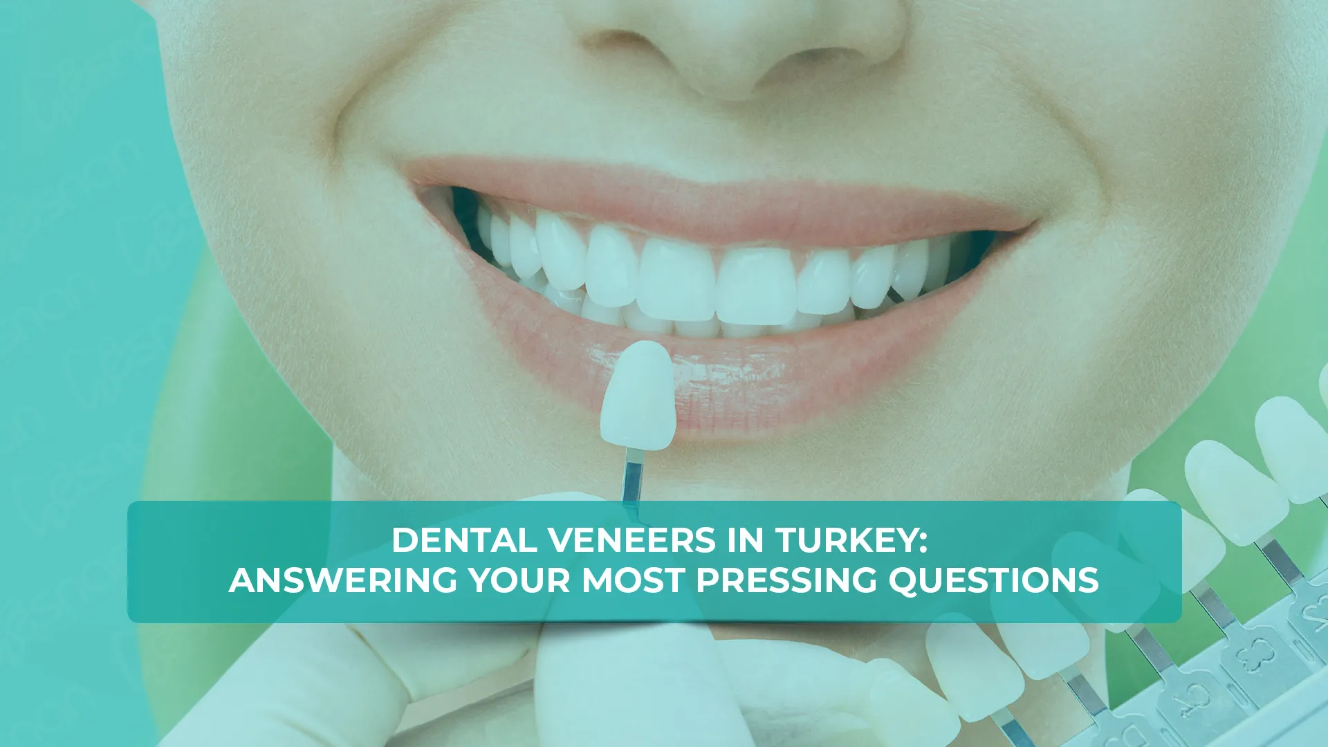 Smiling woman with dental veneers in Turkey