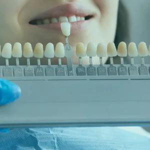 Dental preparation phase in a clinic