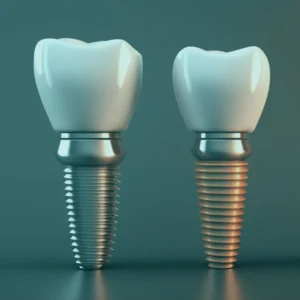 A series of X-rays showing the evolution of dental implant technology in Istanbul, from early models to modern, state-of-the-art implants.