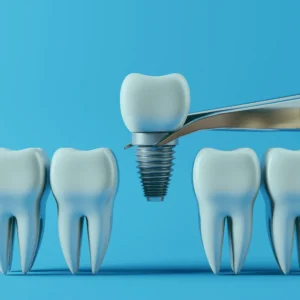 A 3D rendering of a futuristic dental implant procedure in Turkey, showcasing robotic arms and advanced imaging technology.