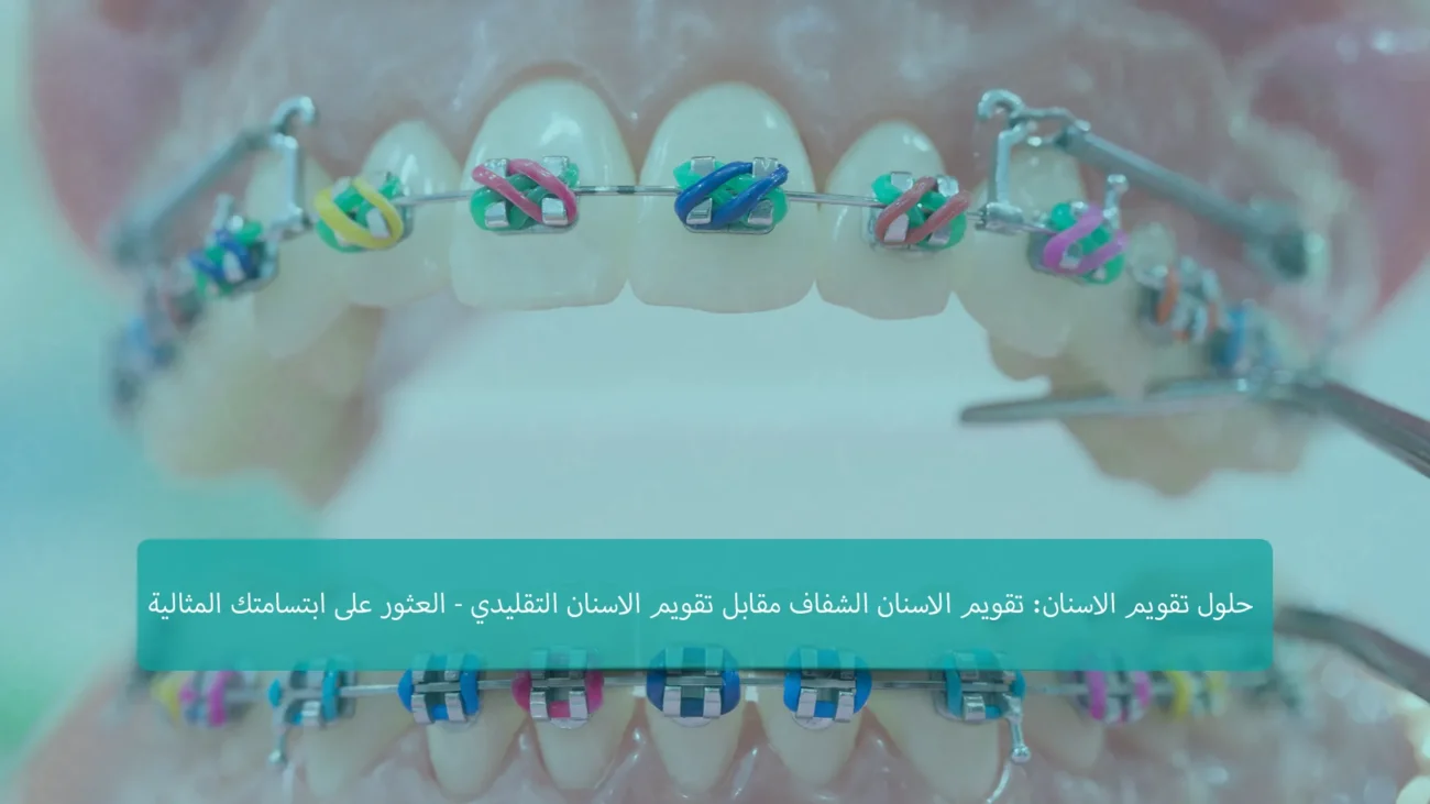 الاختيار بين التقويم الشفاف وتقويم الأسنان في تركيا؟ اعثر على حل ابتسامتك المثالي مع إرشادات الخبراء لدينا. استكشف الخيارات المصممة خصيصًا لاحتياجاتك