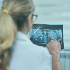 زراعة الأسنان في تركيا; اكتشف إمكانية الوصول المتزايد إلى رعاية الأسنان في تركيا. تعرف على مبادرات توسيع خدمات طب الأسنان.