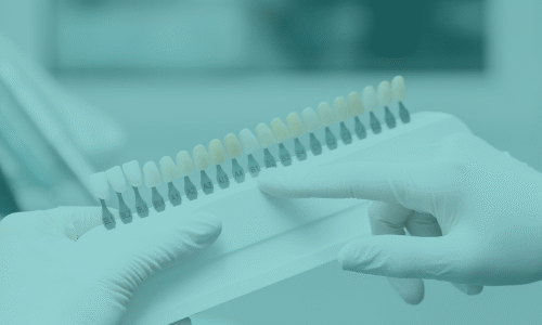 Veneer ve Kron Seçimi: Gülüş Dönüşümü İçin Kapsamlı Bir Rehber