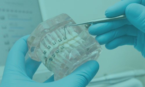 Ortodontik Tedavi Hakkındaki Yaygın Mitler