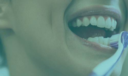 Diş Beyazlatma için Kapsamlı Bir Rehber