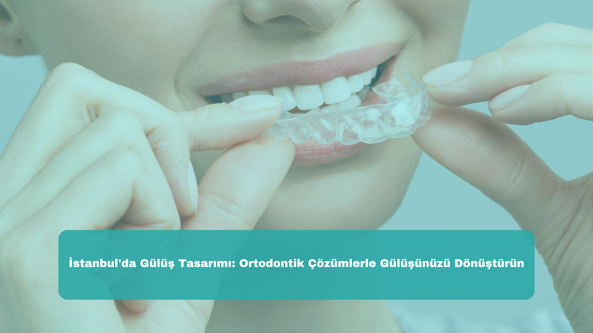 İstanbul'da Gülüş Tasarımı: Ortodontik Çözümlerle Gülüşünüzü Dönüştürün