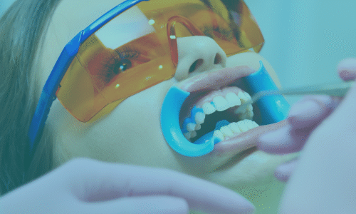 فهم تبييض الاسنان في اسطنبول: الأساسيات والفوائد