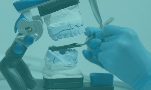 فهم أنواع زراعة الاسنان المقدمة في اسطنبول