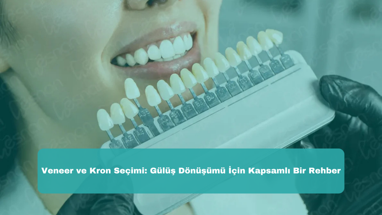 Veneer ve Kron Seçimi: Gülüş Dönüşümü İçin Kapsamlı Bir Rehber