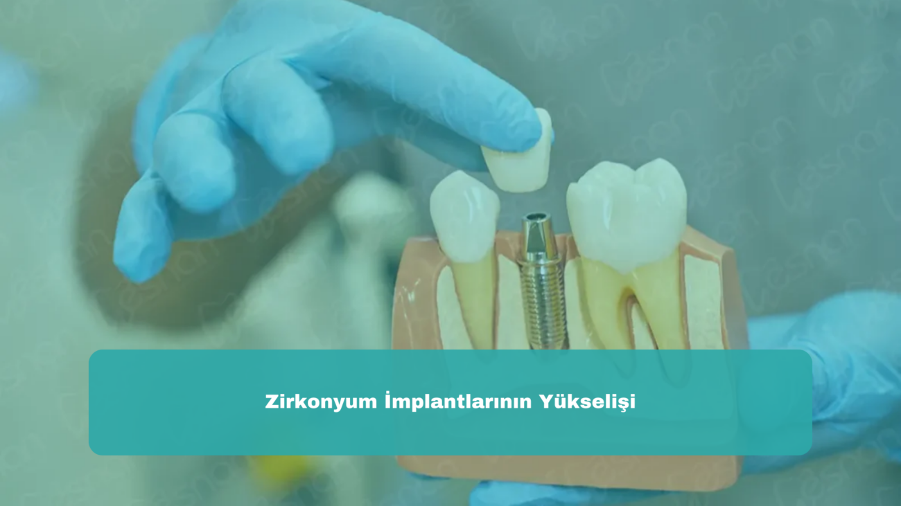 Zirkonyum İmplantlarının Yükselişi